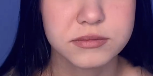 Screenshot 2022 11 06 at 06 46 18 Women ascends with fillers
