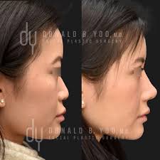 E1AB691A E01A 431A 8D5C 1935A06CD796