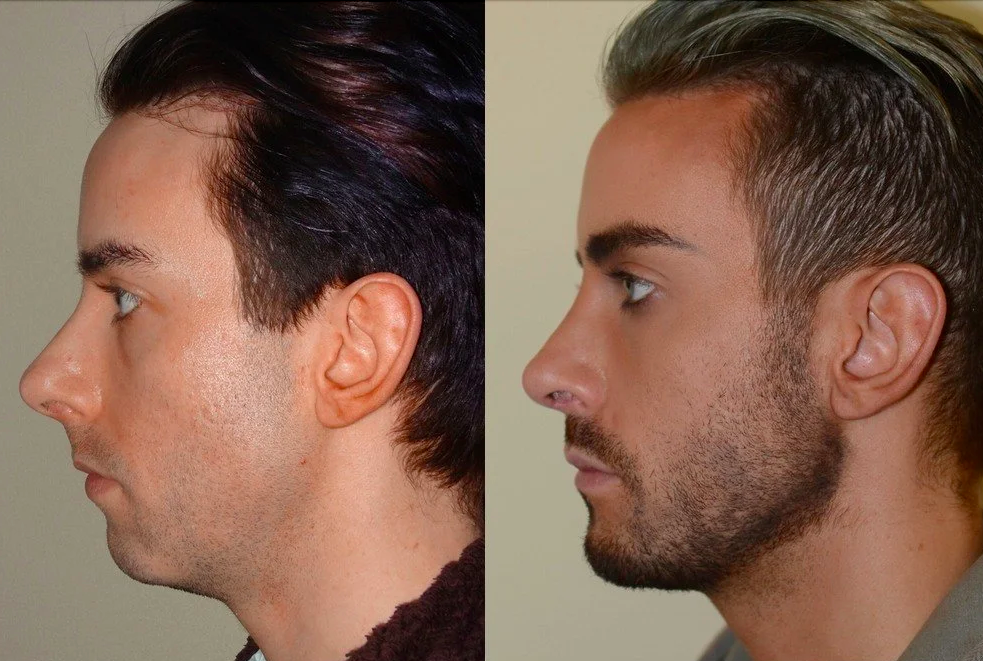 Bildschirmfoto 2022 11 15 um 112959