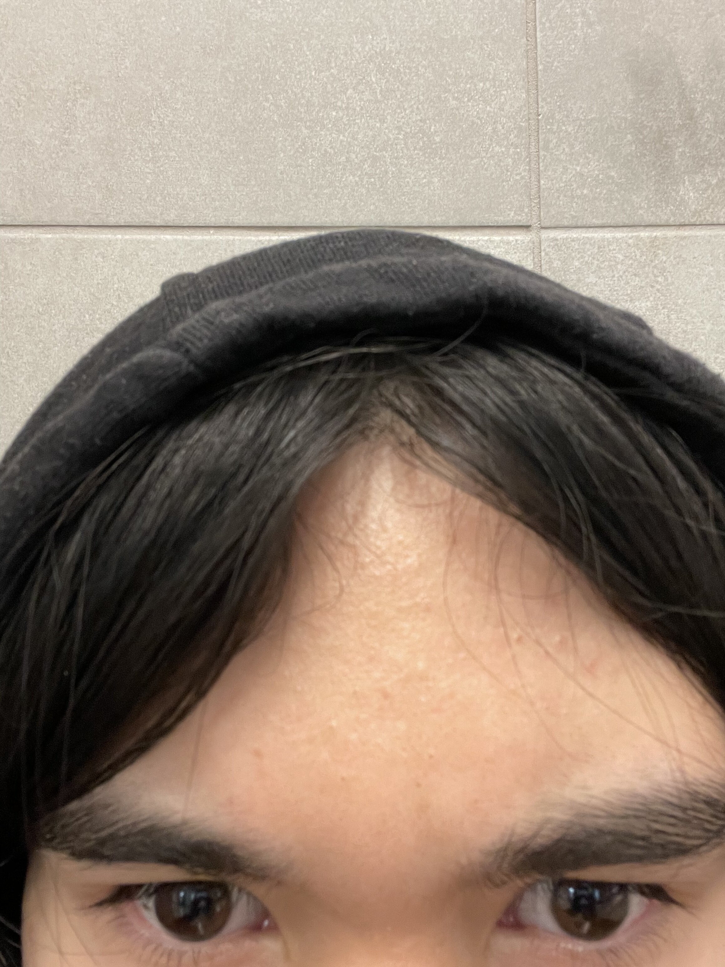 A2E2F6A1 0F23 4294 BD4F 33BB6A2AB6C8