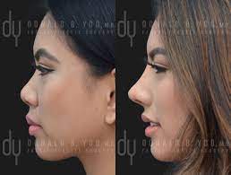 BAD57105 2DF3 4BA7 91B4 61D05761A55D