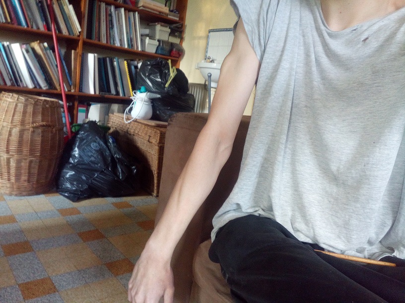 Anox