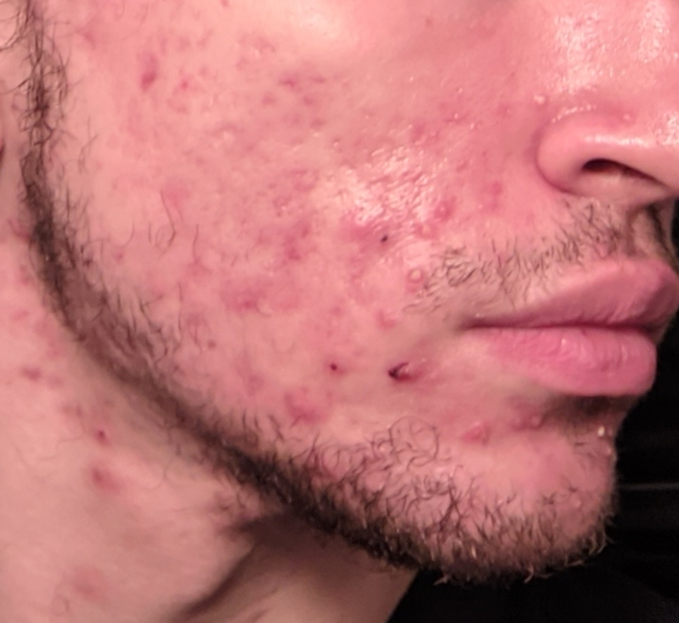 SmartSelect 20221118 044723 Gallery