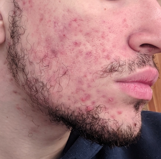 SmartSelect 20221117 110705 Gallery