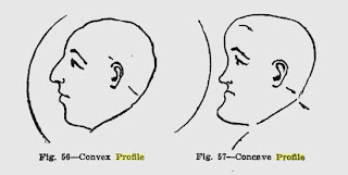 Convex concave