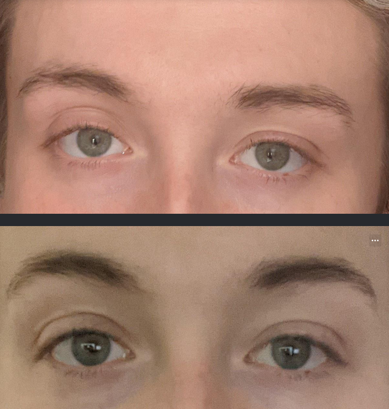 Screenshot 2022 11 29 at 12 20 58 Eyes   Imgur