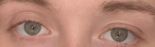 Screenshot 2022 11 29 at 12 26 04 How to fix asymmetrical eyes
