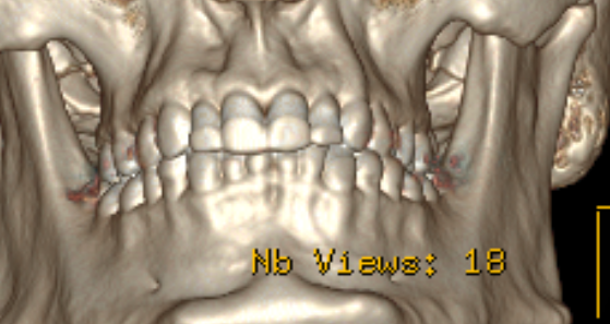teeth1.png