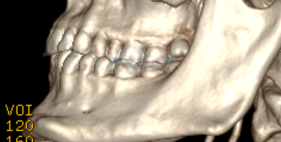 teeth2.png