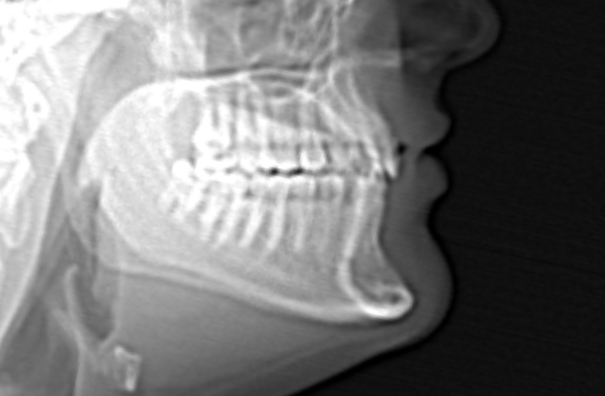teeth3.png