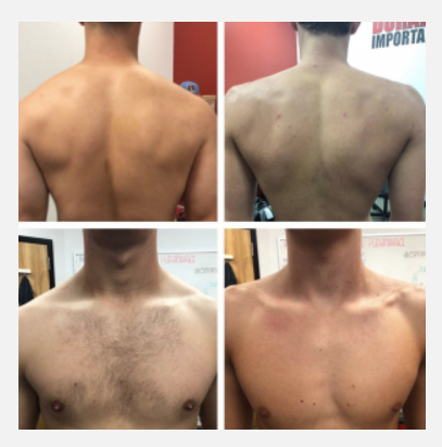 Shoulders Shoulders