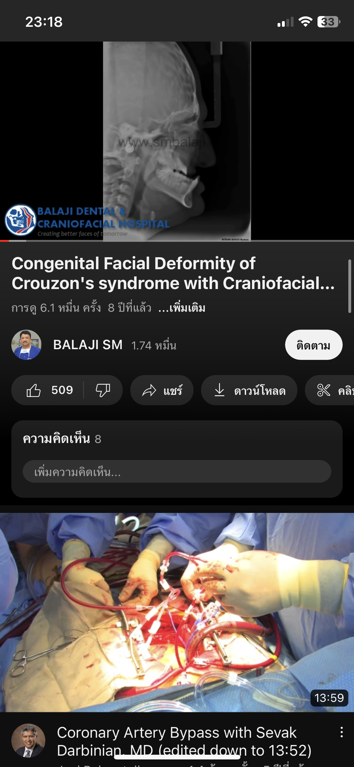 CE6A9BB0 AEB8 4EAB 991E D998EC21ADF8