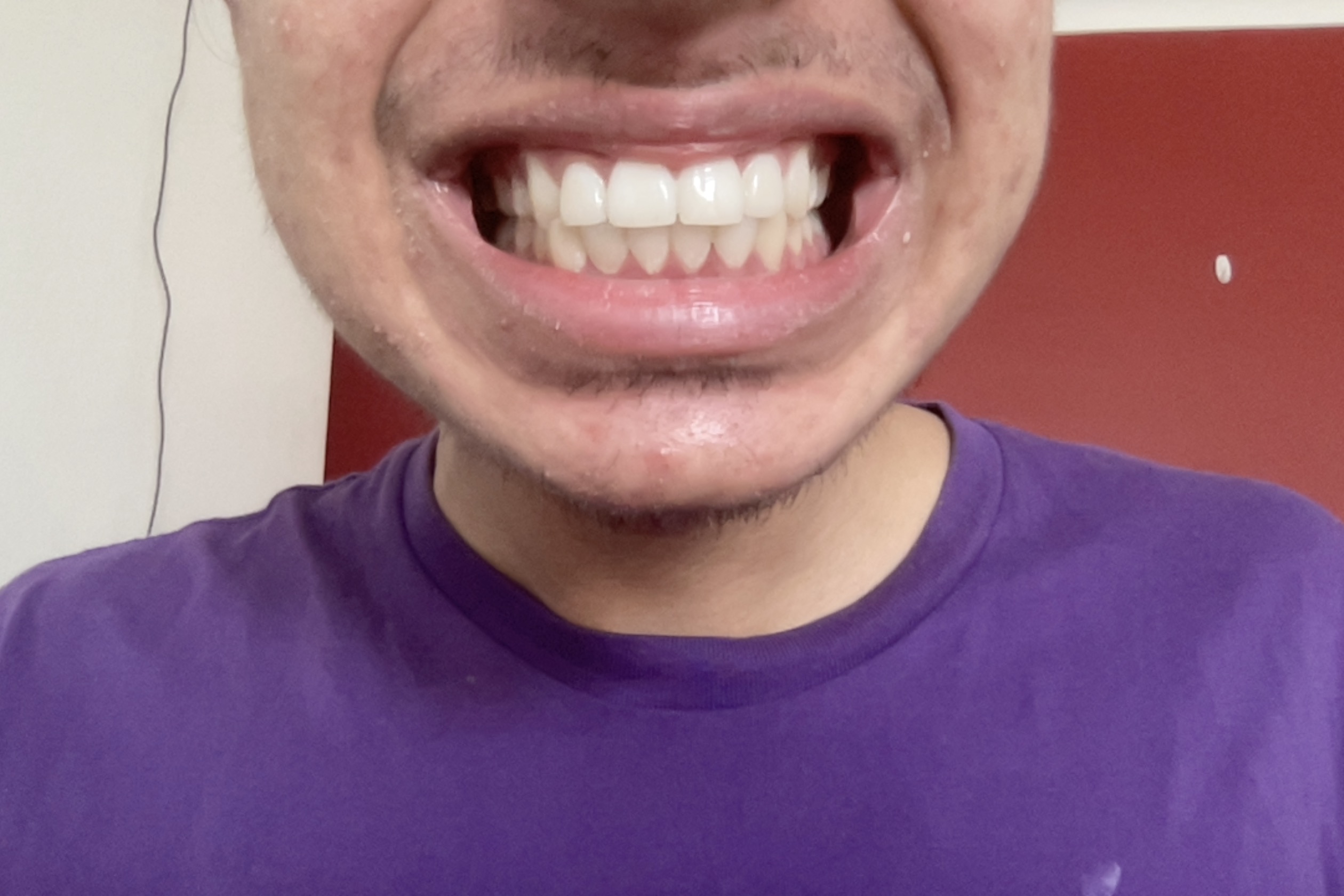 Photo on 18 11 2022 at 447 pm