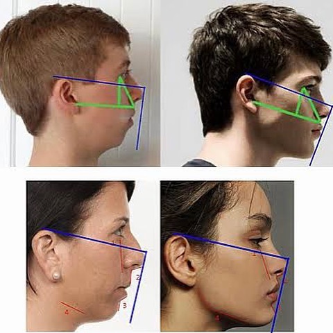 Beingmoreattractive 08122022 0008