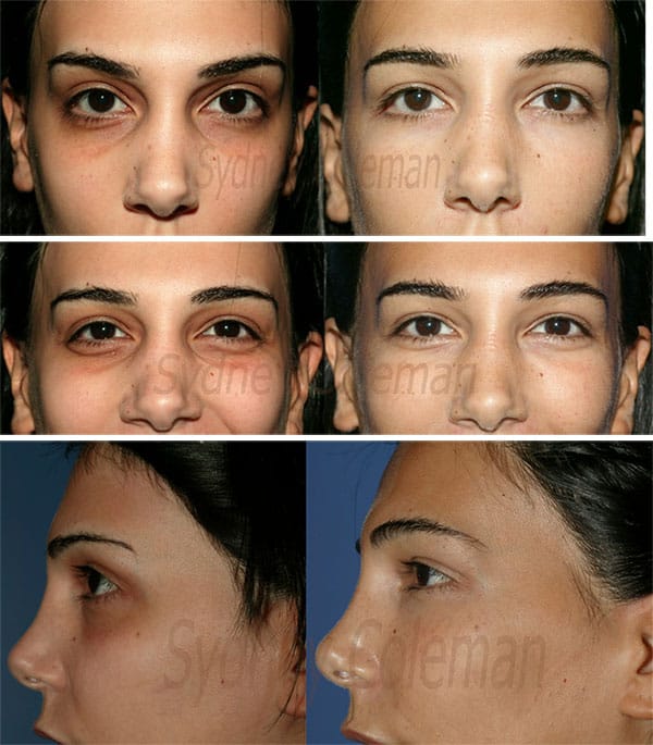 2436549 52E876ED 97C4 4B99 9780 6280F61C38BD