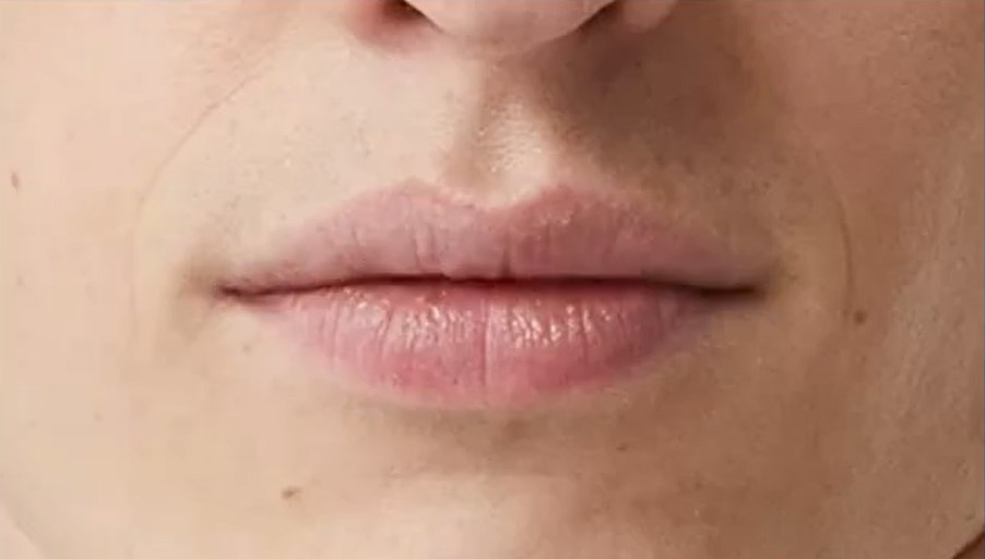 Lips4