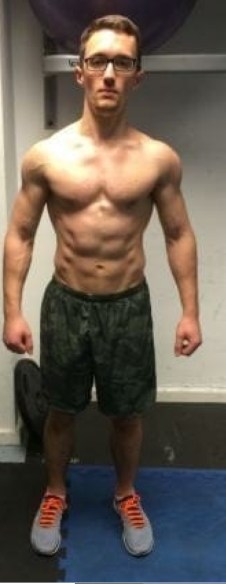 Ugly body 2