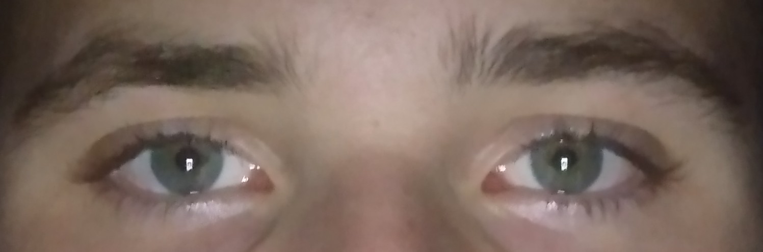 1000001832