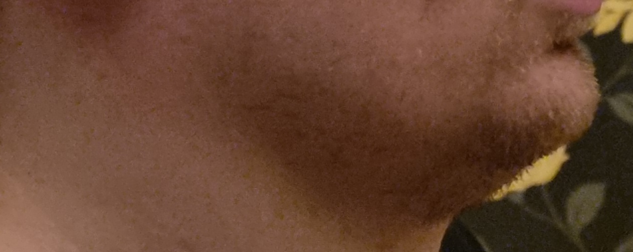 1000002125