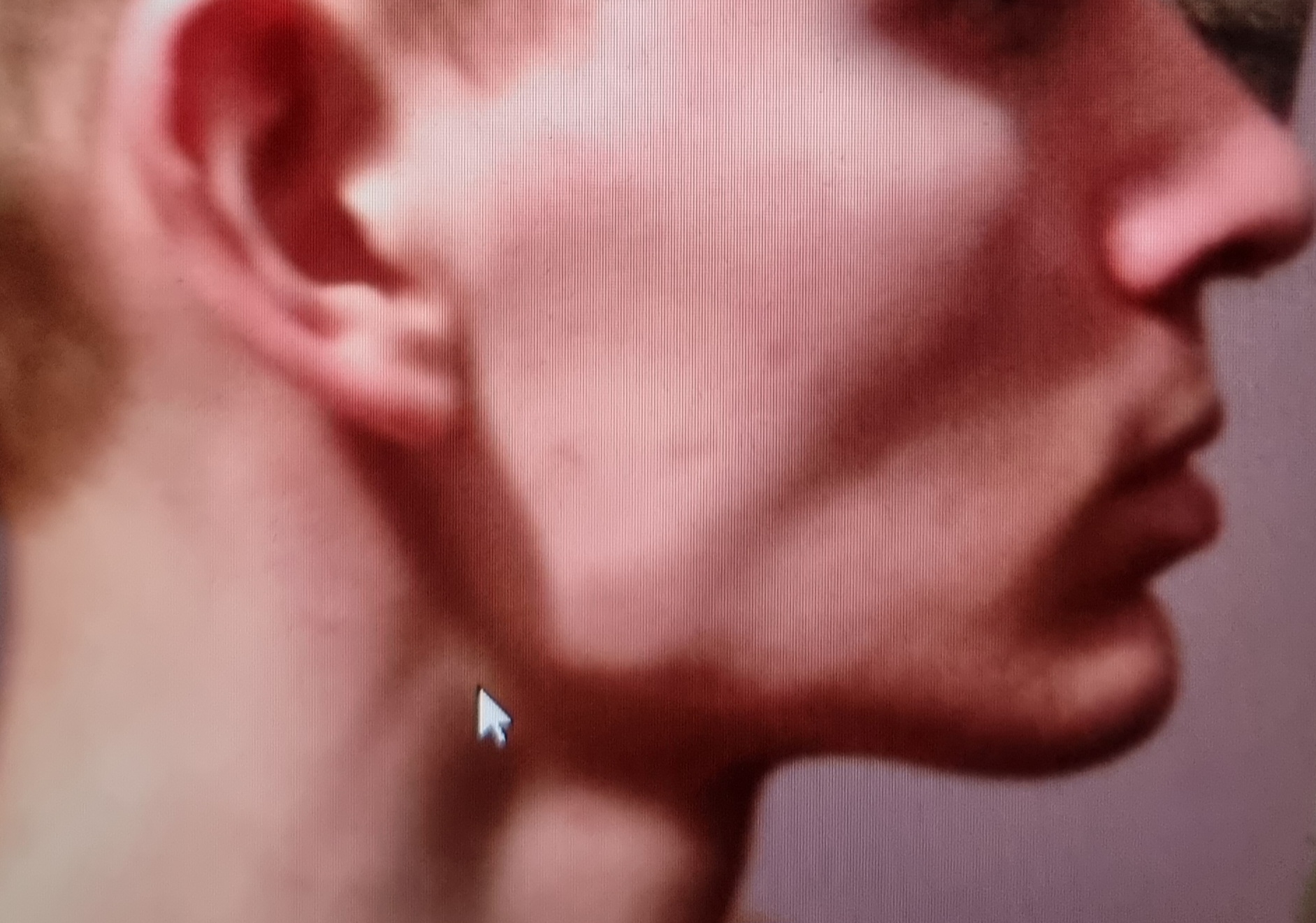 1000000552