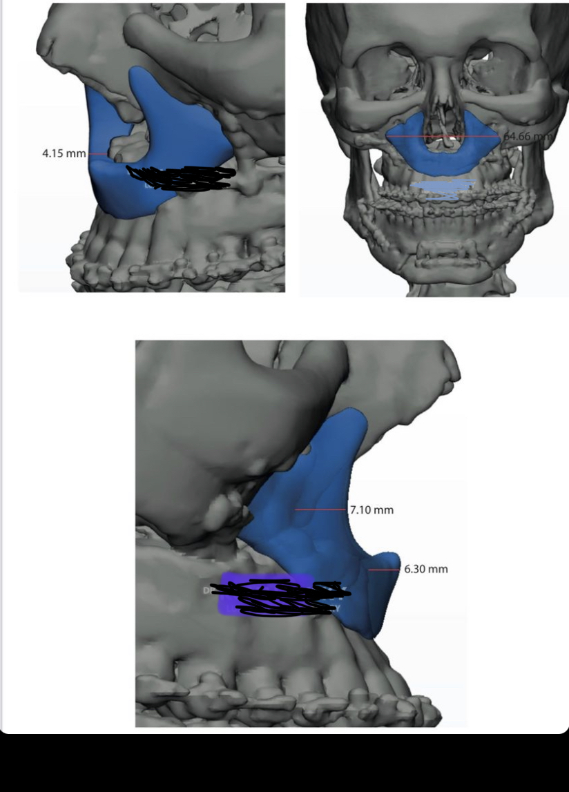 04961378 168F 4023 AD1E 97AFFF63D982