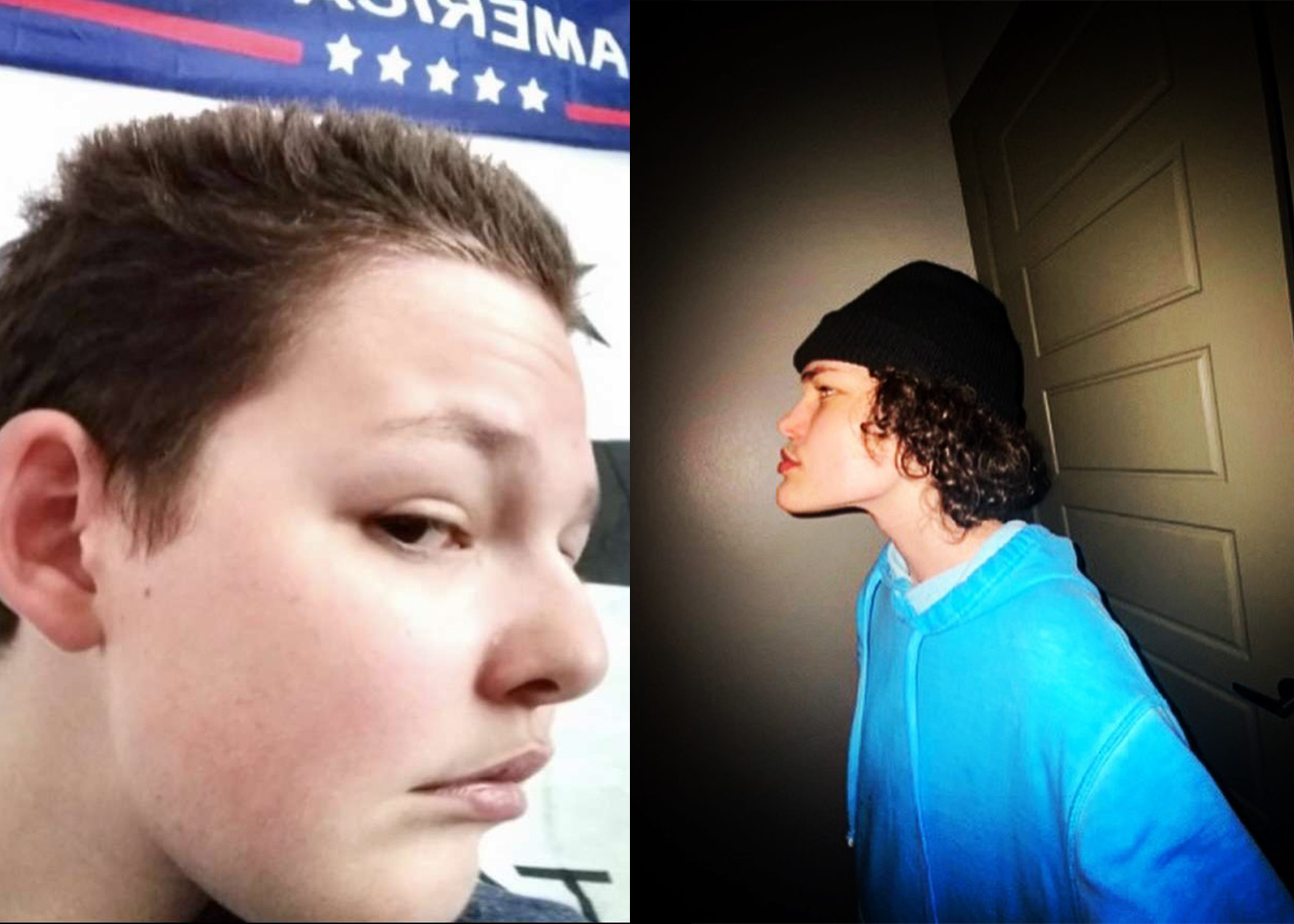 2912572 before and afrer 5