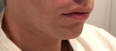 Looksmax 20190719Yaremchuk jaw a userimage 14115dc0 c009 4b60 9188 80eb1c0e89de