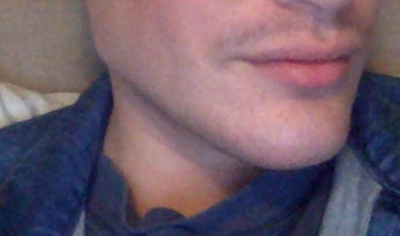 Looksmax 20190719Yaremchuk jaw a userimage dce67247 f427 4fad 91e1 1defce4a25b2