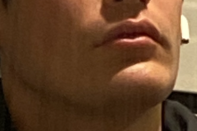 Looksmax 20190719Yaremchuk jaw b userimage 1dd06075 48f6 40f1 8732 d1e14fc49ead