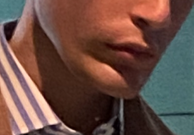 Looksmax 20190719Yaremchuk jaw b userimage 373c6d44 0c13 49fb 8b6a ca72a991c67b