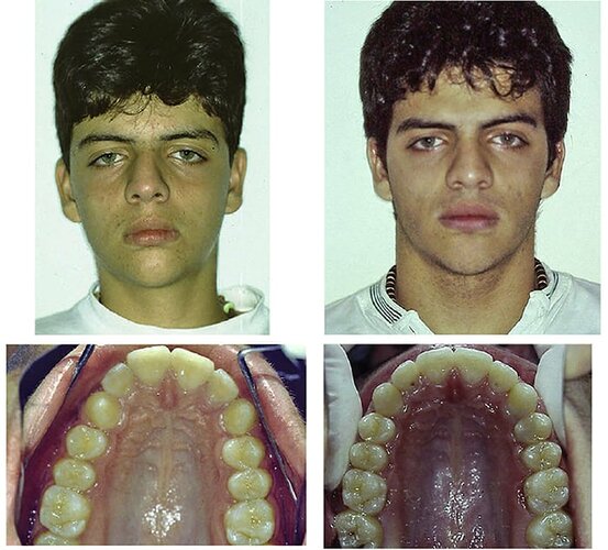 MSEbeforeandafter.jpeg