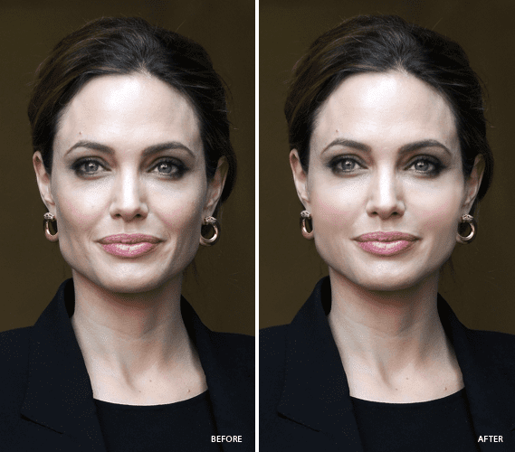 19879 defy aging with fat angelina jolie