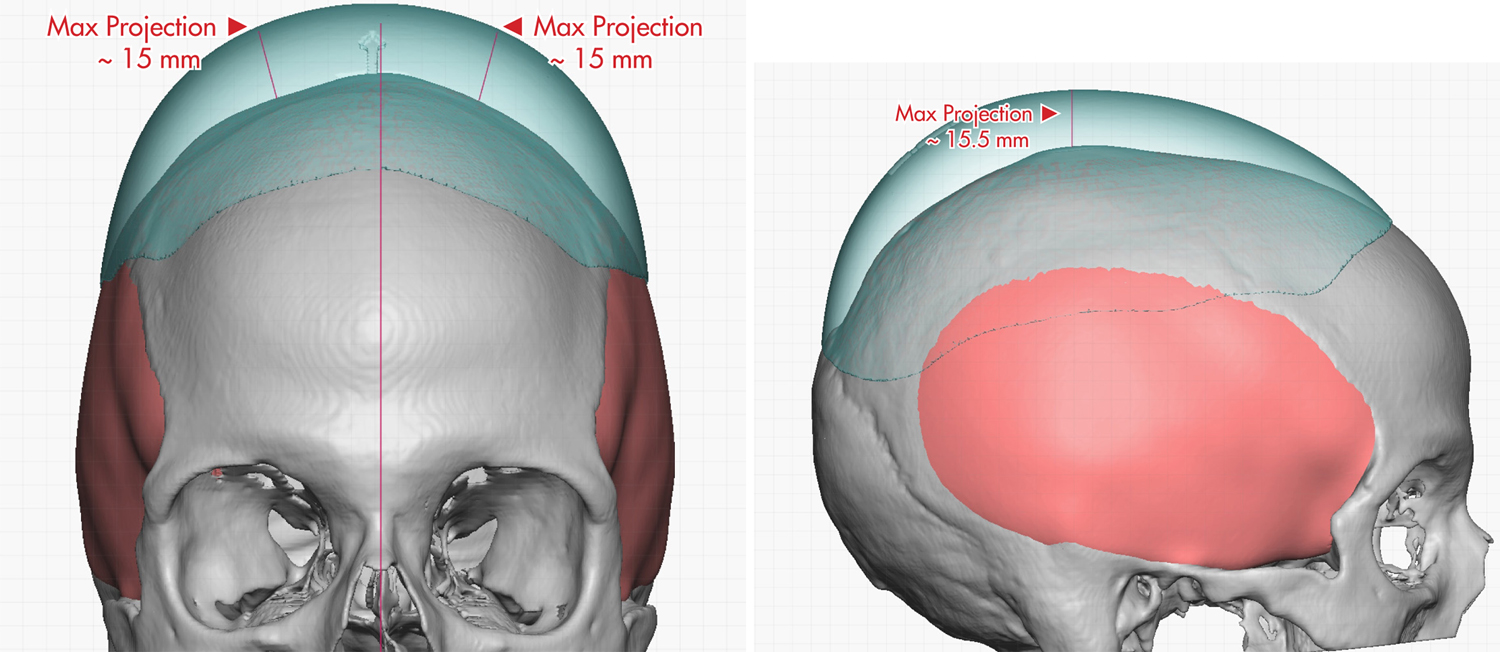 1F23923E BC82 449E AB05 7B4C26A8558D