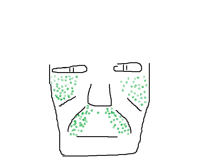 Dermastamp