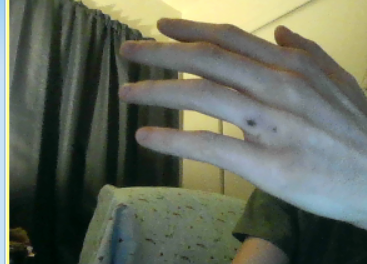 Hand
