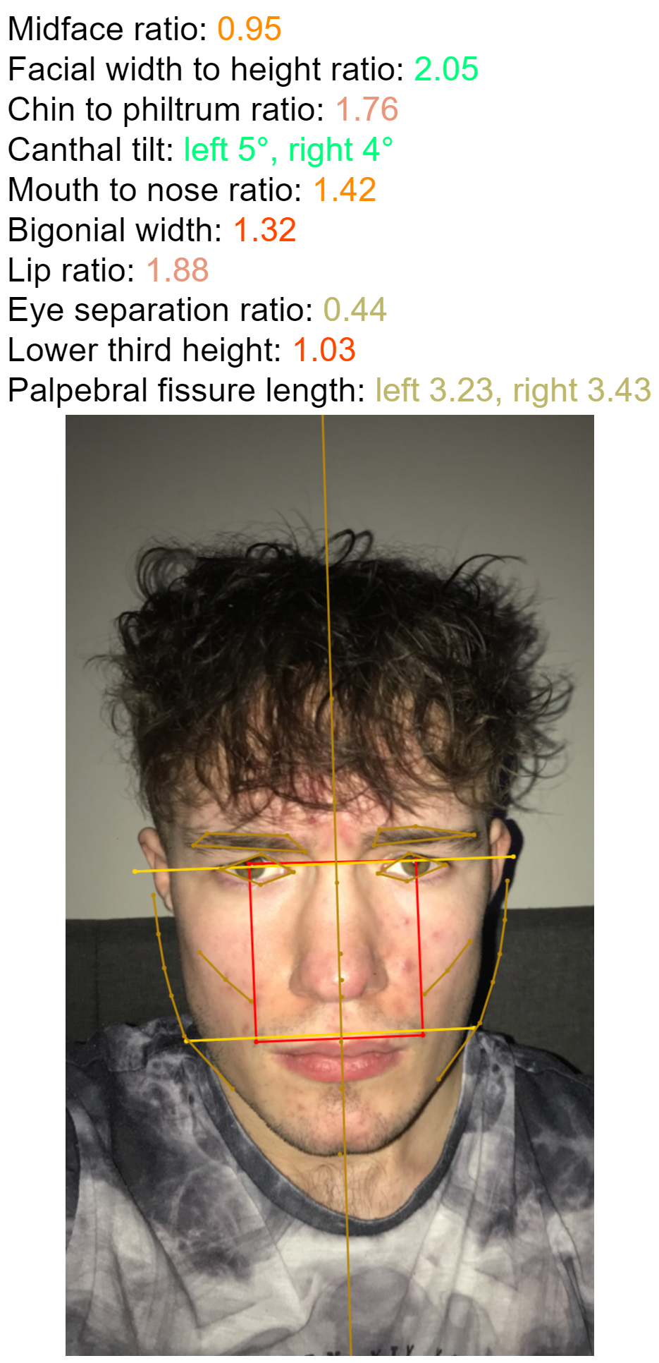 3236437 20E62CF3 8F61 4F35 AA41 599987793CE3 looksrated