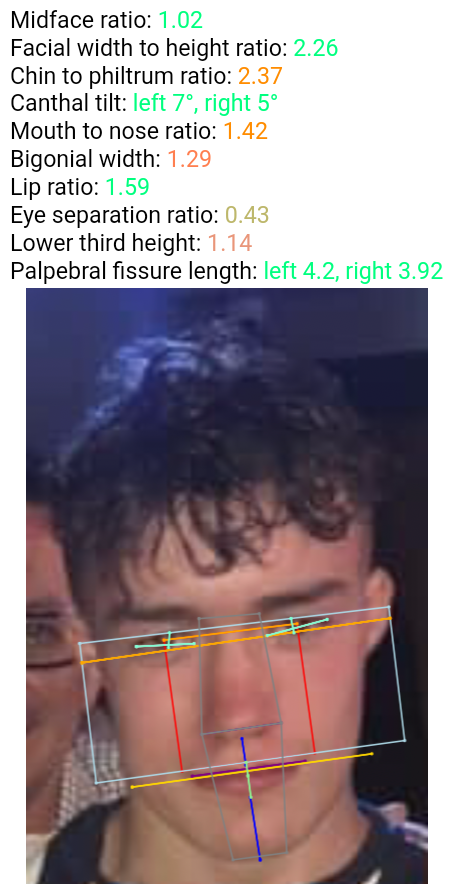 3235314 1B18C0CF 86CE 4433 9074 76608791569C 2 looksrated