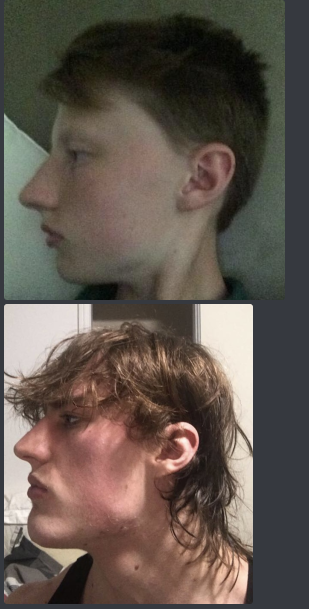 Loox bones transformation