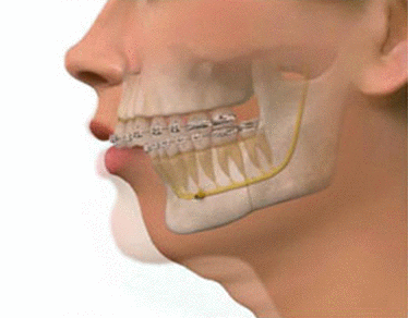 Cirugia maxilofacial hospital quiron doctor ruiz villandiego dentista donostia san sebastian u