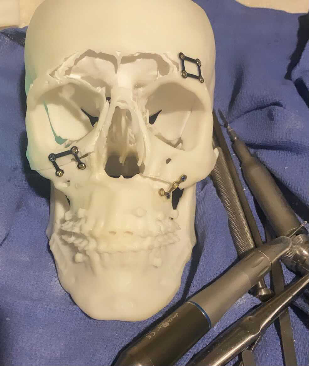 7F5B2715 4388 46B5 9B76 BDCE9ADE2C0A