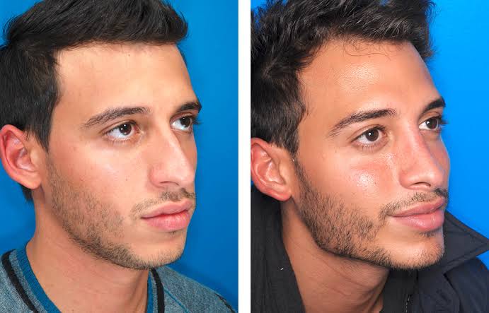 F3191F49 EE17 4F26 8B1C FB18B667D2E0