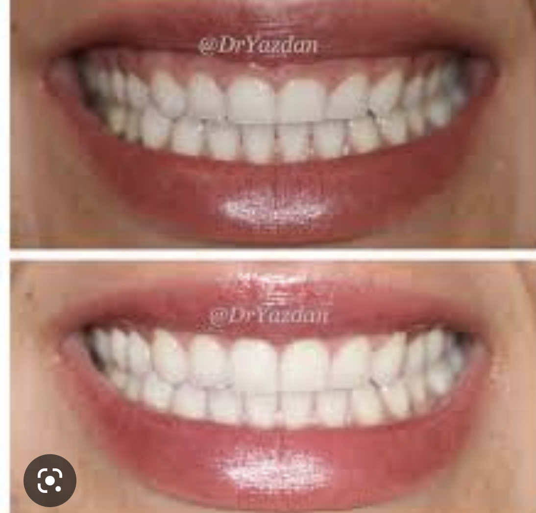 FBB59327 E20A 4CE6 9DDE 460E0A894638