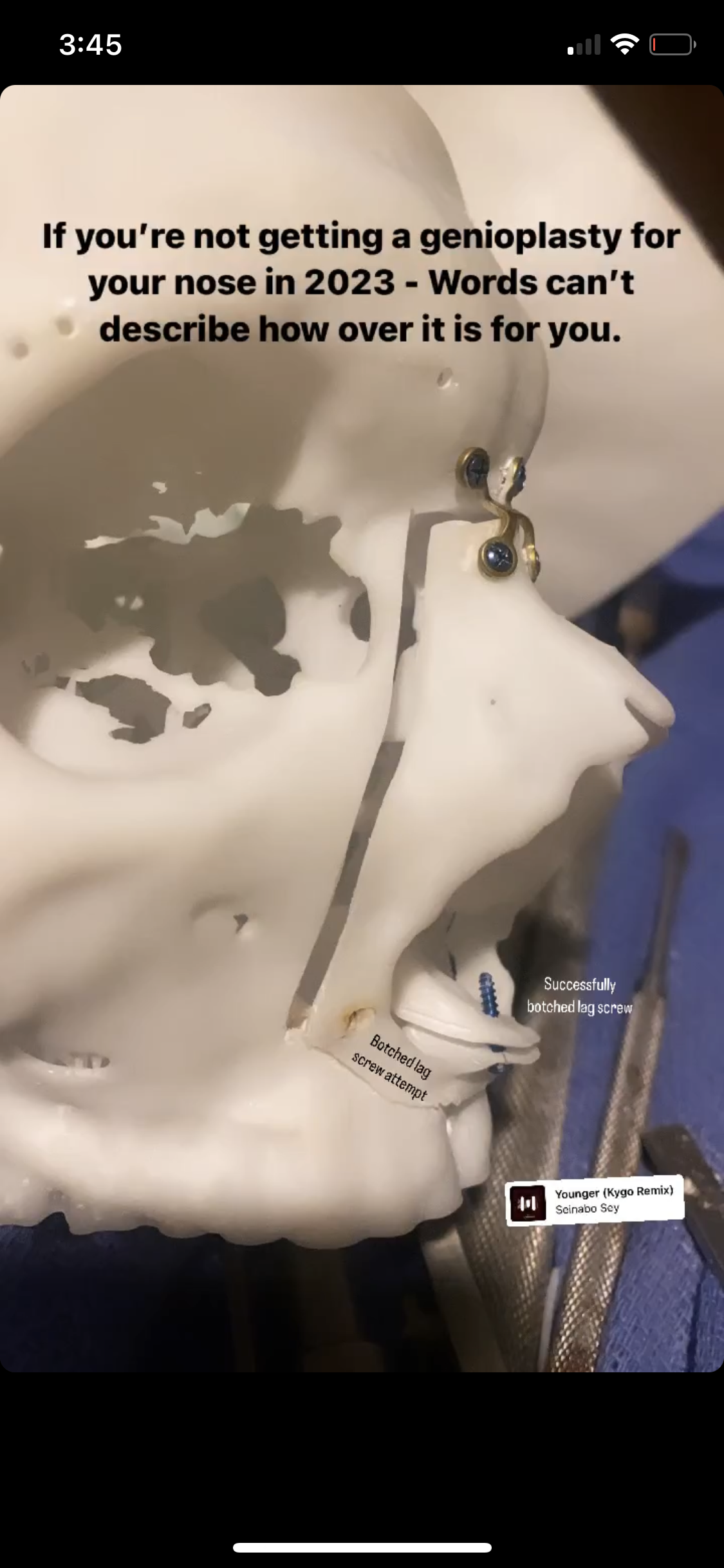 C95FB85B 22FE 44B0 9639 F8E931317DE6