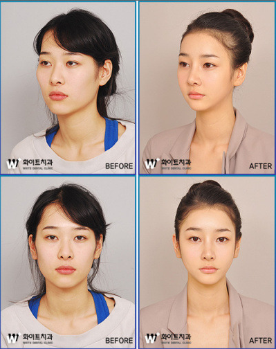 Surgery