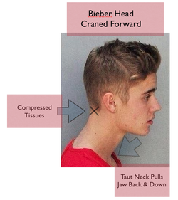 Bieber