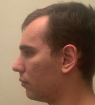 Face4