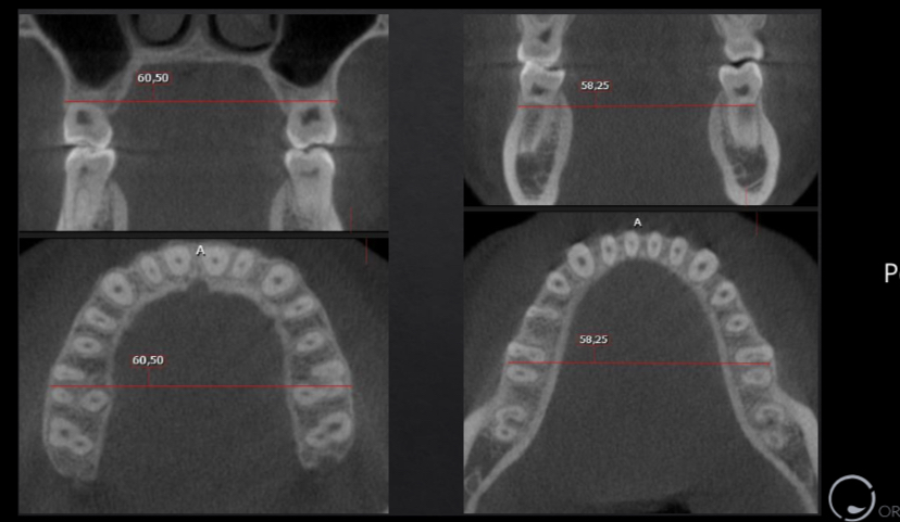 F2FE9FB8 AF55 41A9 8708 79A075A69035