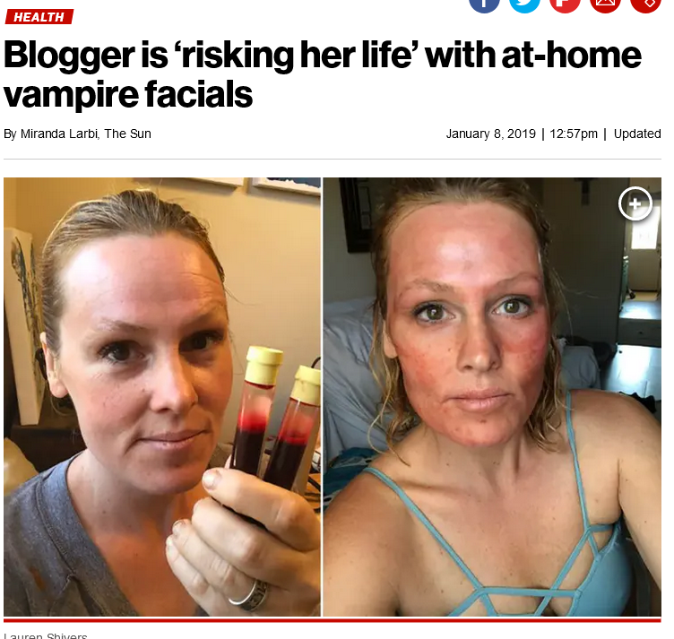 Screenshot 2023 01 26 at 19 45 02 Blogger is risking her life with at home vampire facials