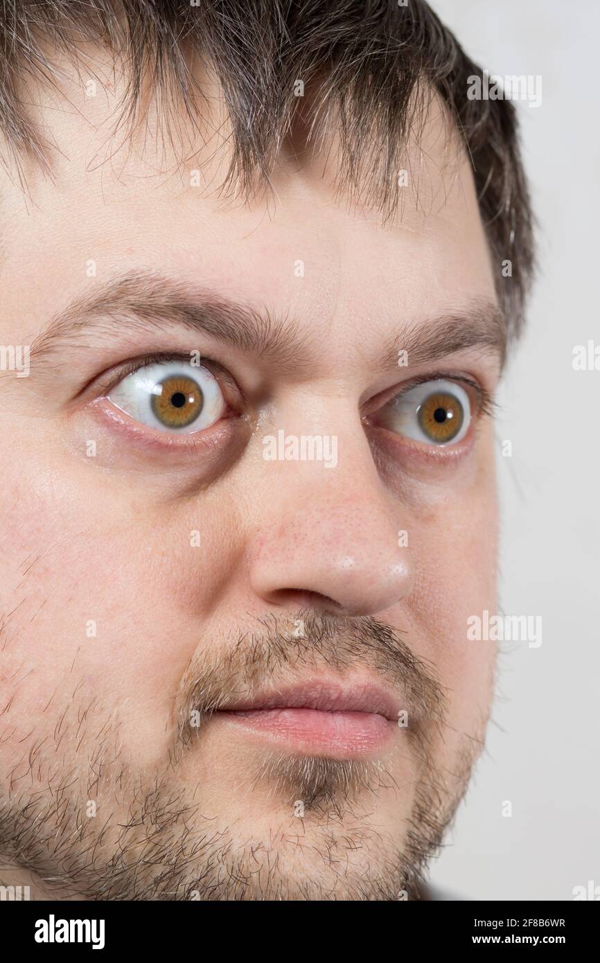 Surprised eyes of a man vertical photo for text big bulging eyes to advertise discounts sales 