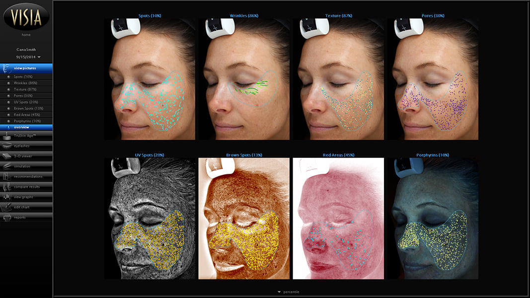 VISIA Overview screen RGB
